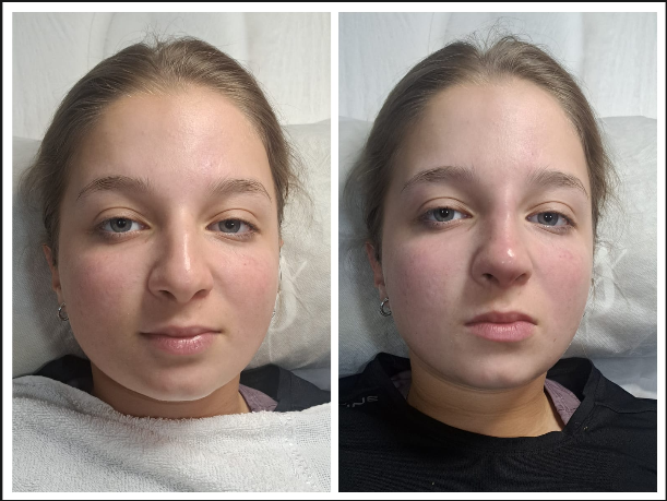 Tratamiento dermatológico