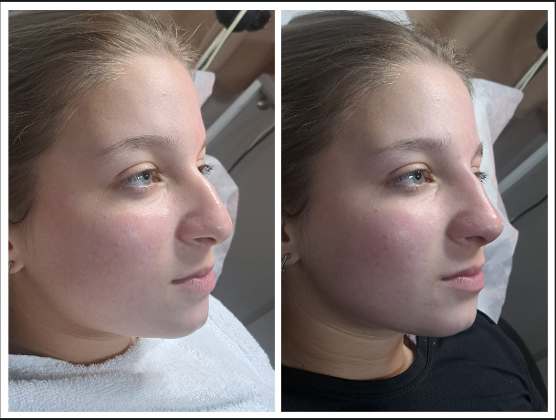 Tratamiento dermatológico