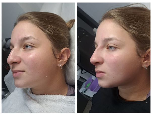 Tratamiento dermatológico