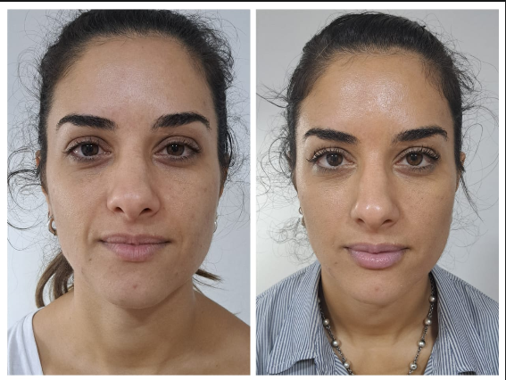 Tratamiento dermatológico