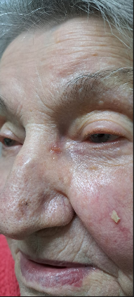 Tratamiento dermatológico